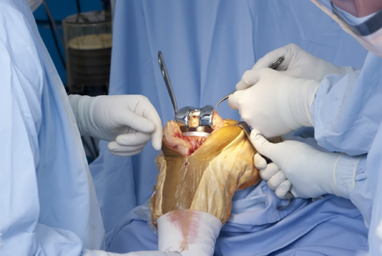 طب جراحة العظام